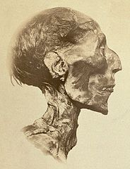 Ramses II's mummy